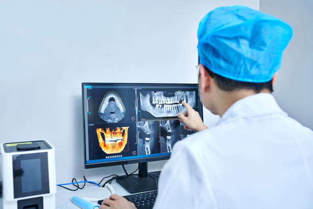 Best Emergency Dental Care for Broken or Chipped Teeth in Parkwood, WA