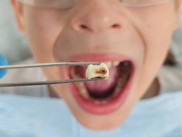 Best Pediatric Emergency Dentist in Parkwood, WA