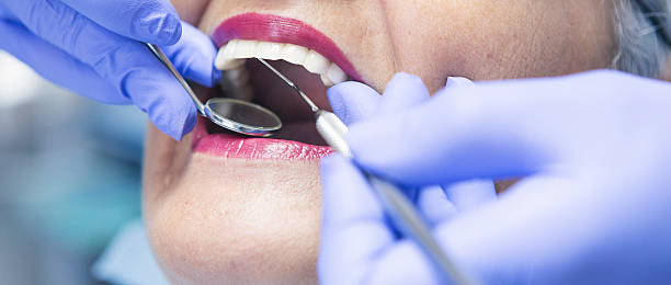 Best Urgent Care for Lost Fillings or Crowns in Parkwood, WA